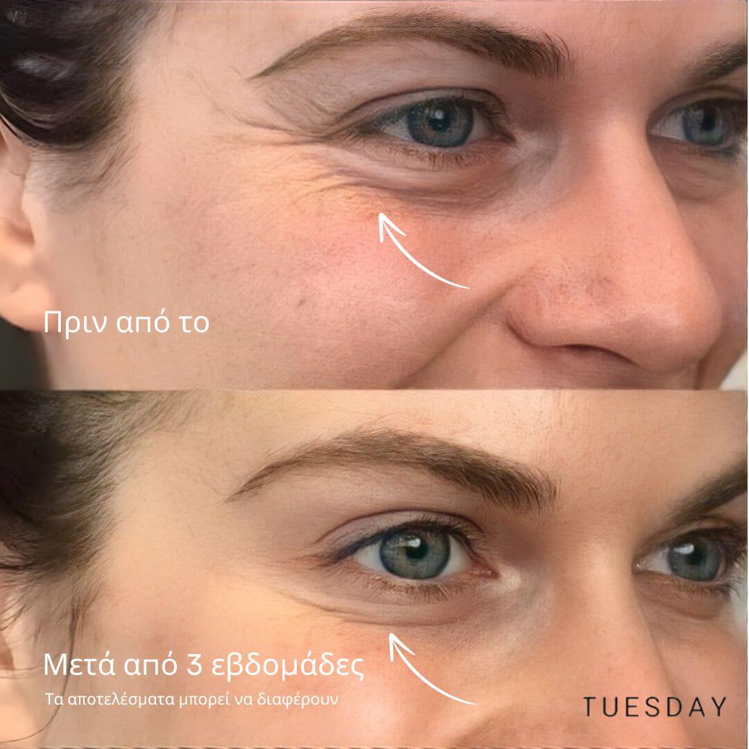 GlowLift Ρετινόλη Στικ Ματιών