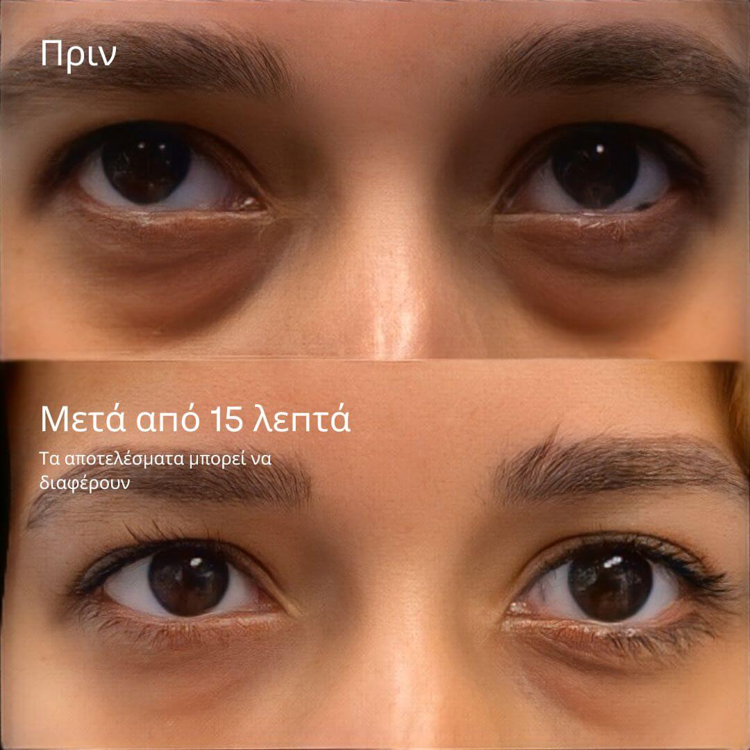 24K Gold Eye Mask για Ξεκούραστο & Αφυπνισμένο Βλέμμα