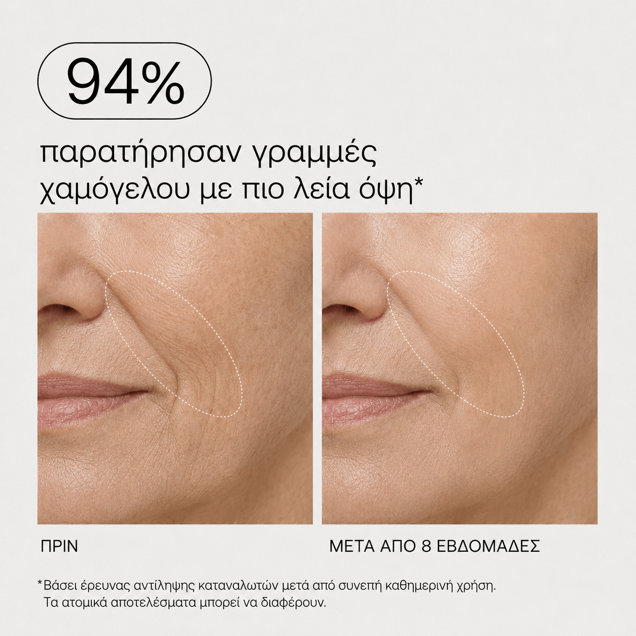 PDRN Βάλσαμο Κολλαγόνου για Πιο Γεμάτη Όψη